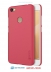  -  - NiLLKiN    Xiaomi Redmi Note 5A-32GB 